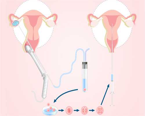 武汉找一个代孕公司,武汉供卵要多少钱（武汉同济做试管多少钱）