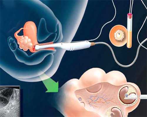 武汉助孕几率高吗,武汉供卵助孕公司排名
