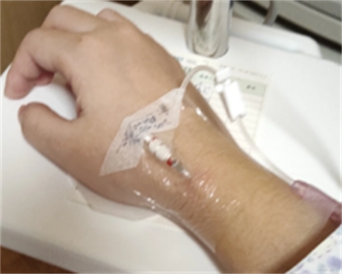 嘉宝助孕怎么样|内江有乙肝能做试管婴儿吗，感染乙肝试管助孕的方法和流程