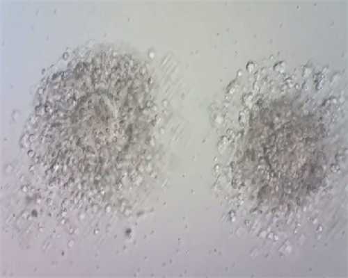 南京试管养囊哪家厉害？为什么要选择胚胎养囊？