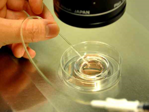 玛丽塔助孕客服电话|格鲁吉亚供卵试管婴儿攻略：流程、成功率、费用抢先看