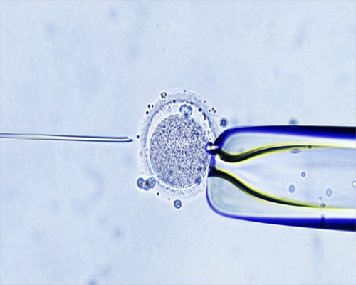 宫颈上皮内瘤变是什么