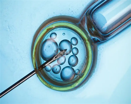 怎样才能生双胞胎？想生双胞胎有什么技巧？