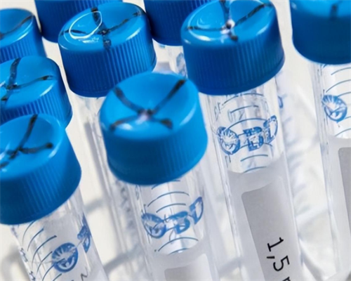 武汉供卵去哪里做,武汉试管婴儿费用大约多少?去武汉做试管贵吗?