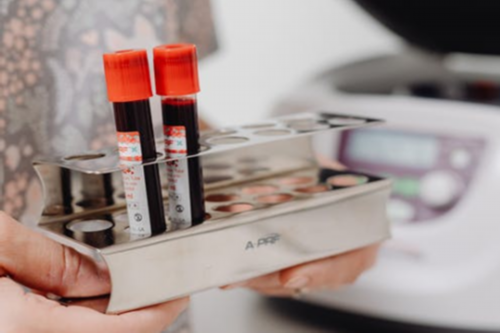 武汉供卵试管哪家最价格低,武汉试管婴儿供卵费用