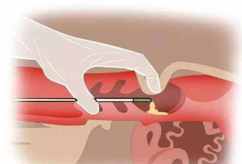 东骏助孕中心靠谱吗|43岁做三代试管婴儿,为什么有的第二次移植比较容易成功