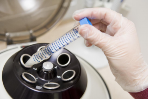 添丁助孕官网|广元内分泌失调如何通过试管技术生孩子，需要结合实际情况而