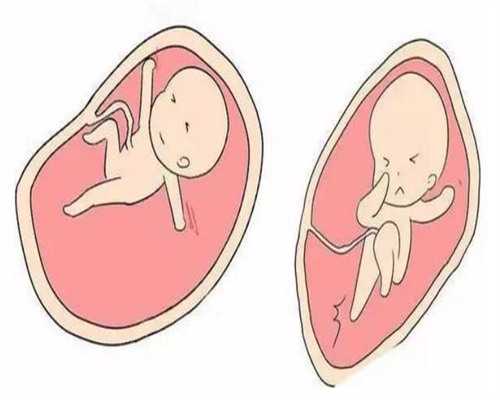 武汉代孕公司,武汉供卵中心，武汉送子鸟医院官网