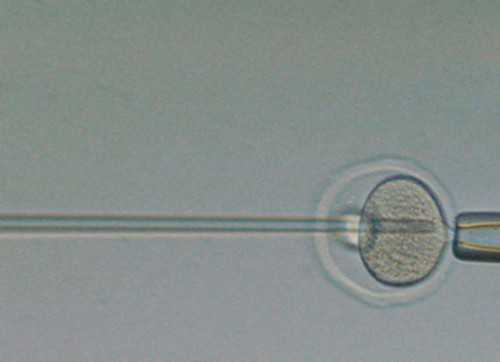 武汉试管婴儿代怀,武汉供卵是第几代试管,武汉供卵三代试管