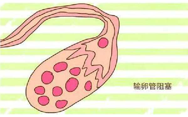 武汉做供卵要多长时间 武汉中南医院生殖科医生介绍 ‘胎囊看男女图解’