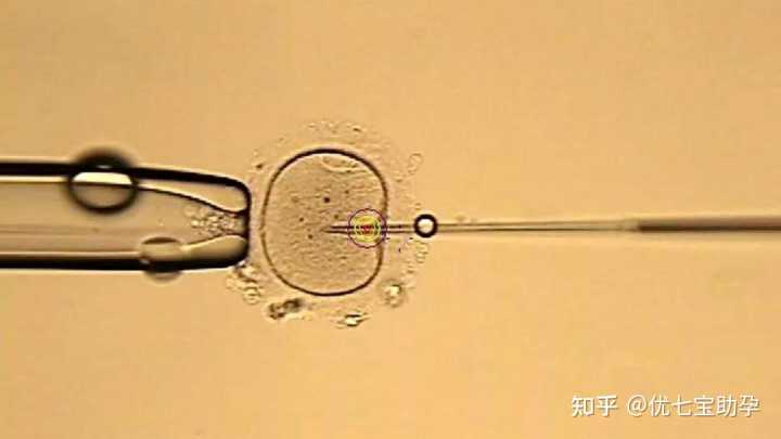 广州有哪些知名助孕中心,广州三大助孕机构坤和.团队怎么样-诛仙手游飞升15